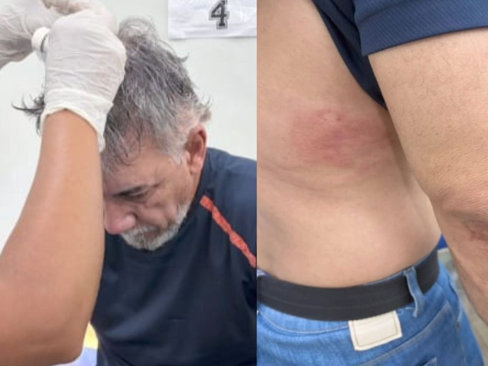 Jornalista é agredido e ameaçado após invasão de sua casa no Acre