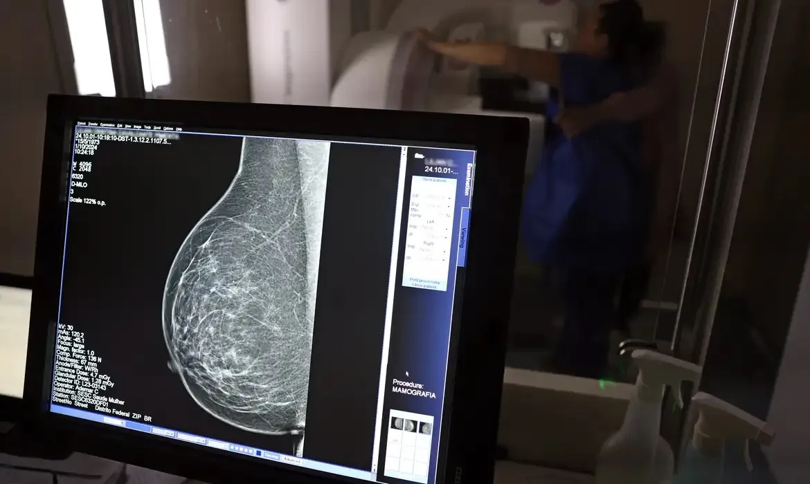 SUS implementa teste genético para detecção de risco hereditário de câncer de mama