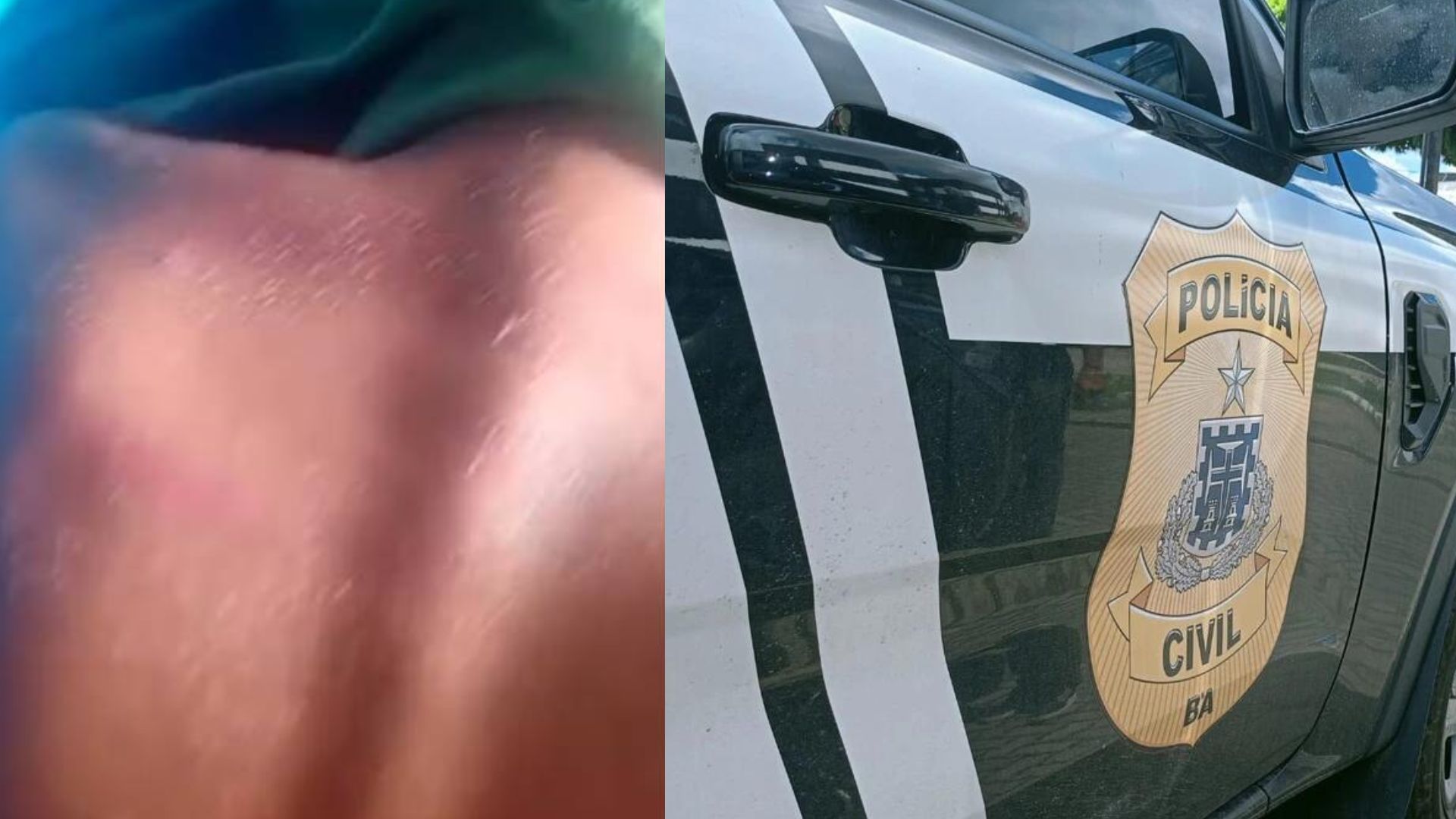 Professor é investigado por agredir criança de 8 anos na Bahia